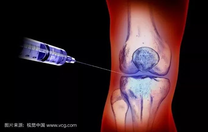 1658814895845660.jpg 干細胞修復關節炎.jpg